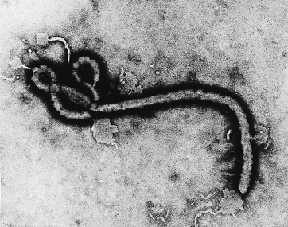 Ebola Zaire